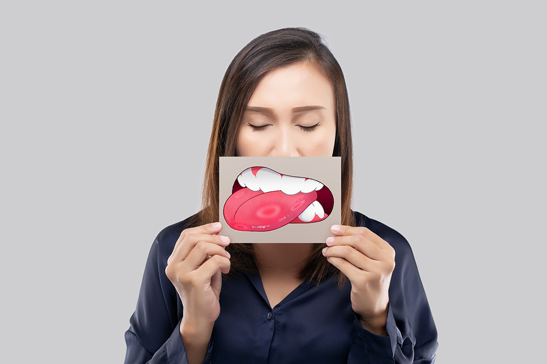 Cancer buccal
