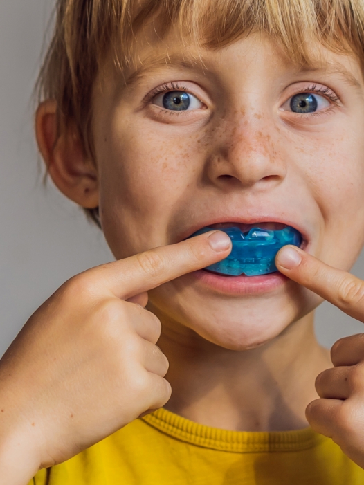 Protecteur buccal quand et pourquoi devrait-on le porter Protecteur buccal quand et pourquoi devrait-on le porter